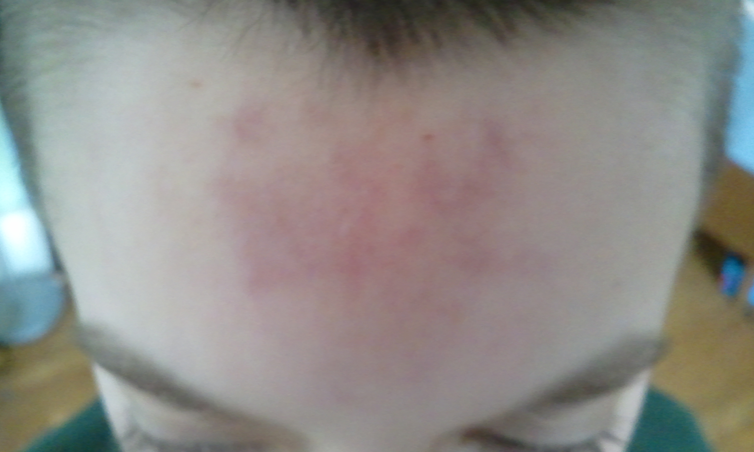 Autism, self-injury and "outside the box" thinking.