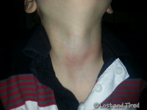 Do your kids hurt each other?