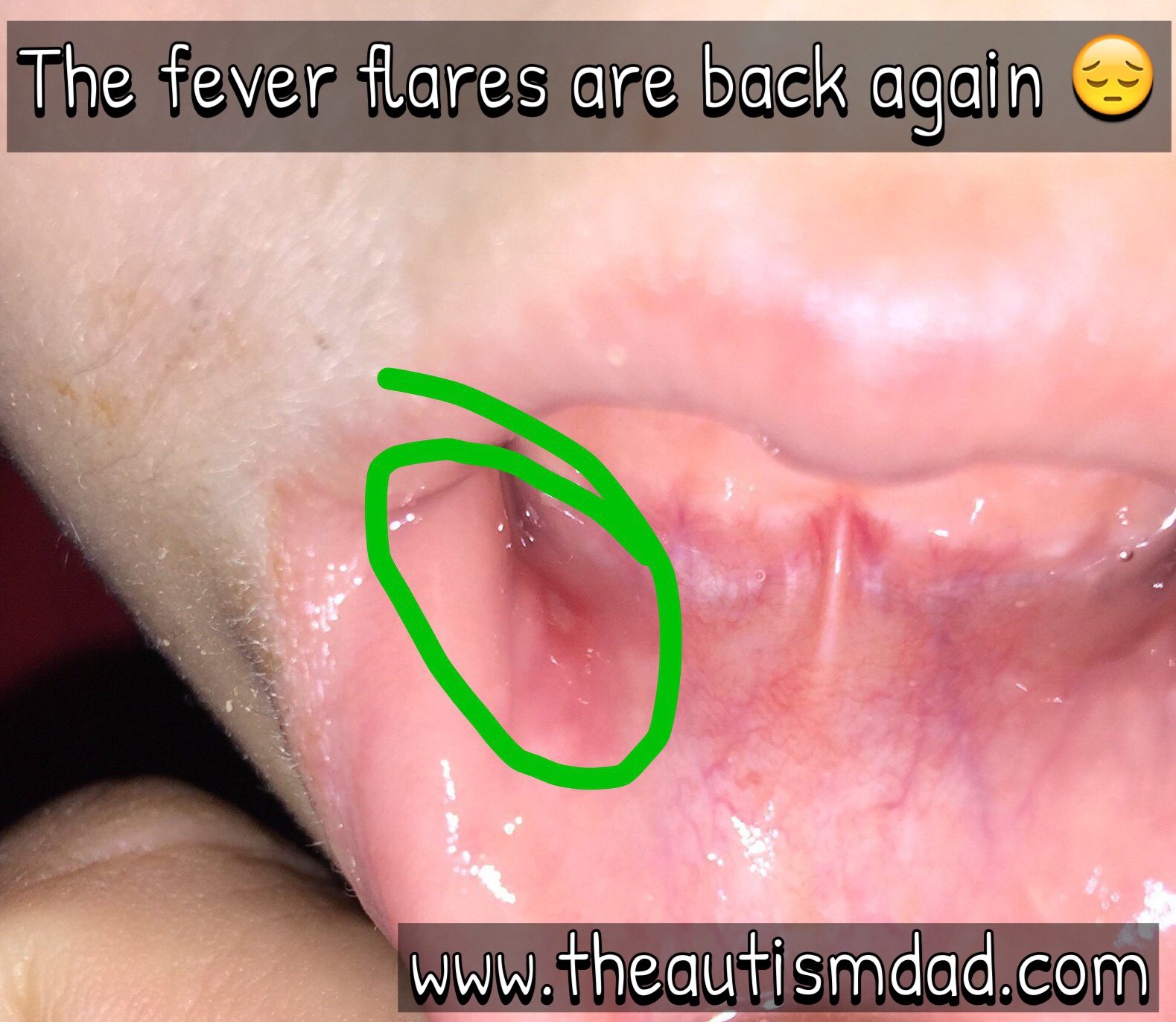 Emmett could use some thoughts and prayers tonight