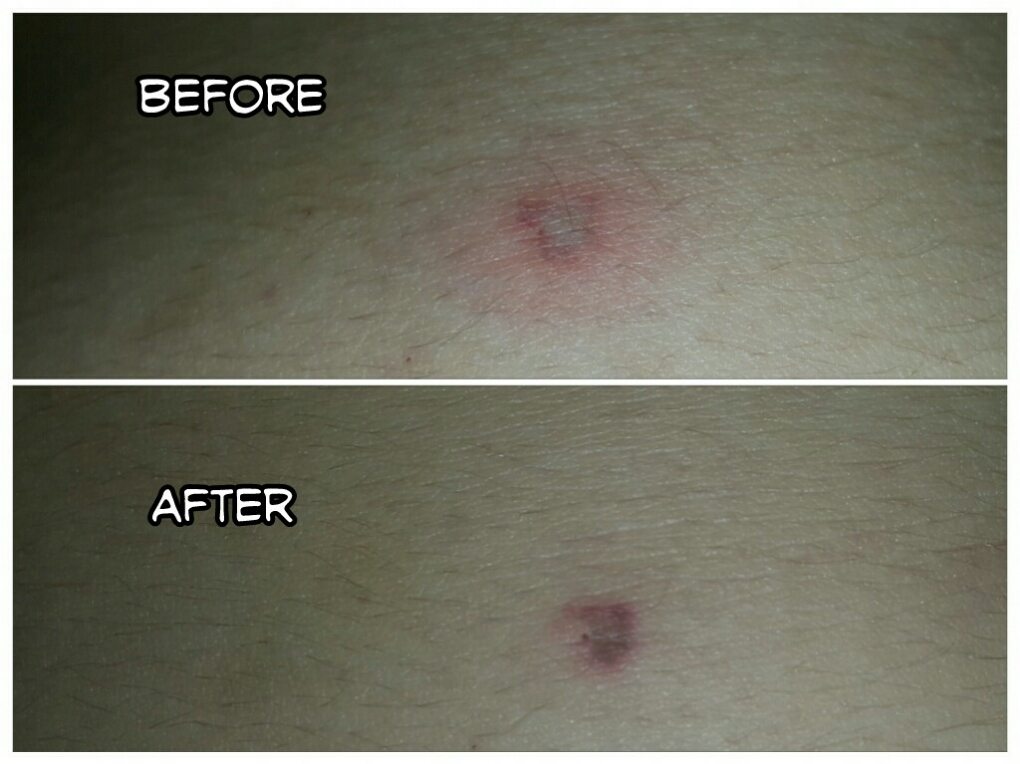 Gavin dealt with an infection this week