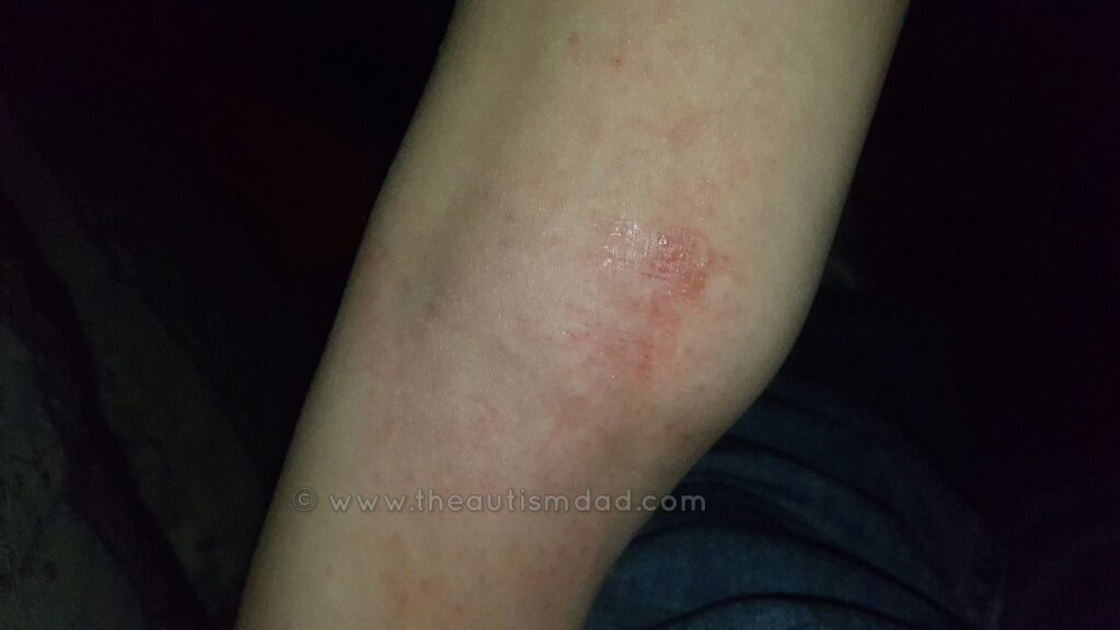 I feel like we just can't catch a break