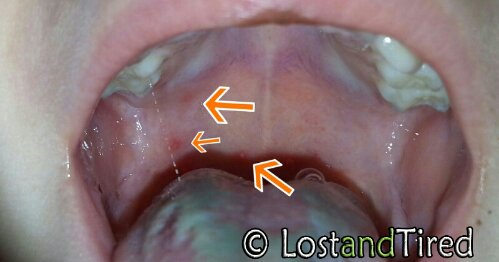 I thought we were in the clear.....