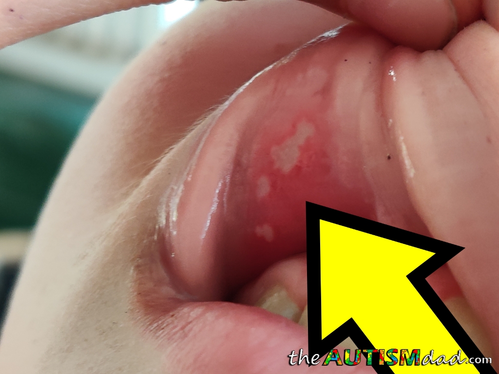 I wish I could take away his pain