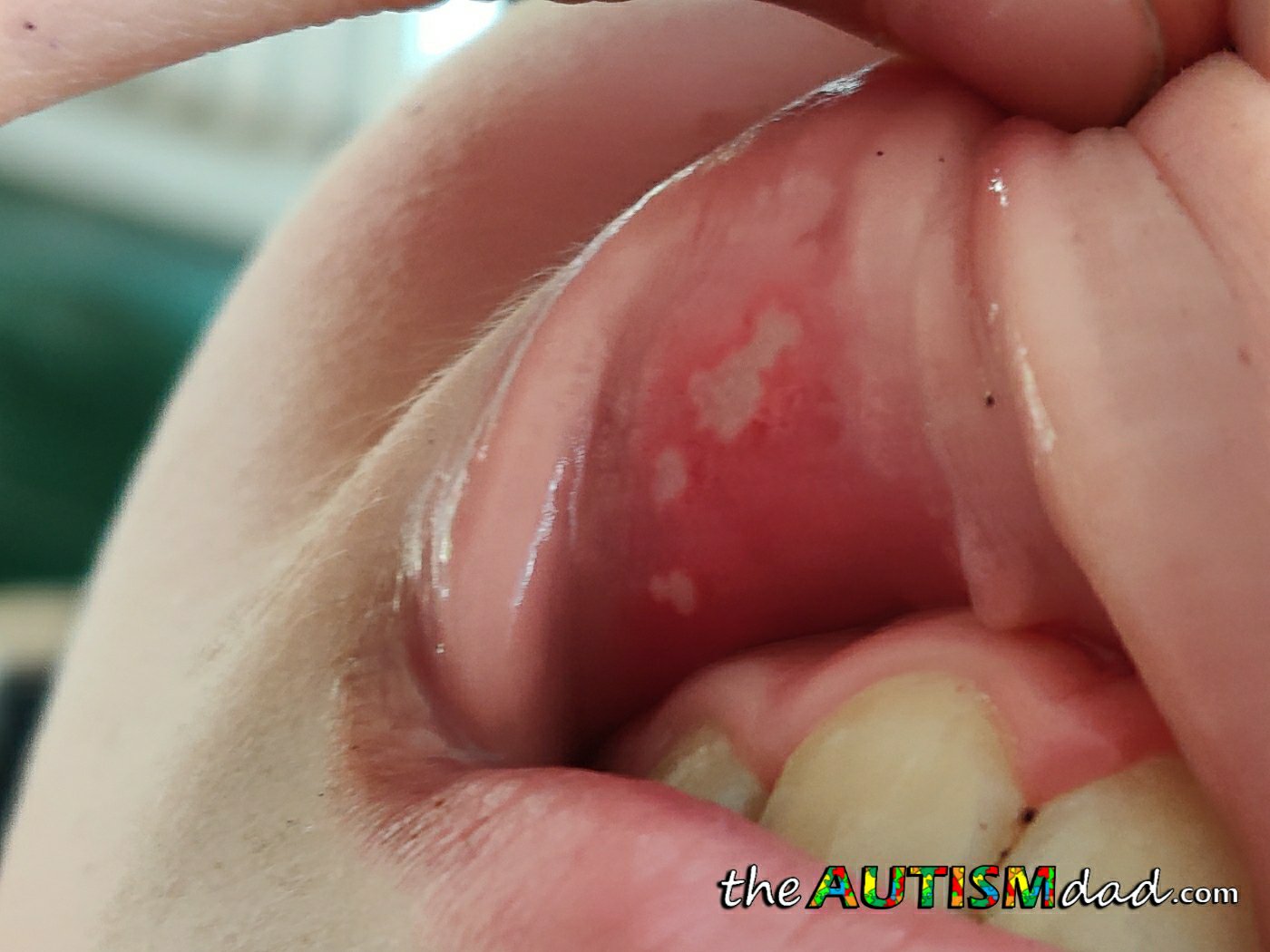 I'm trying to keep everyone's head above water and I'm failing