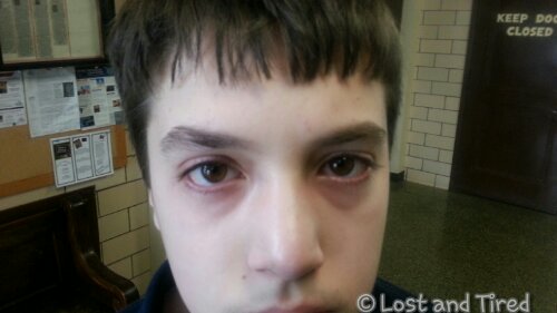 Is this "normal" or something to worry about?