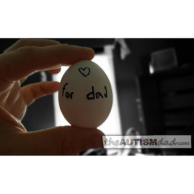 Kids with #Autism can show affection in amazing unique and atypical ways