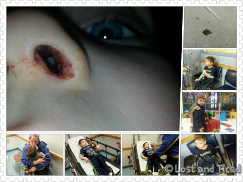 Legos don't belong inside your nose