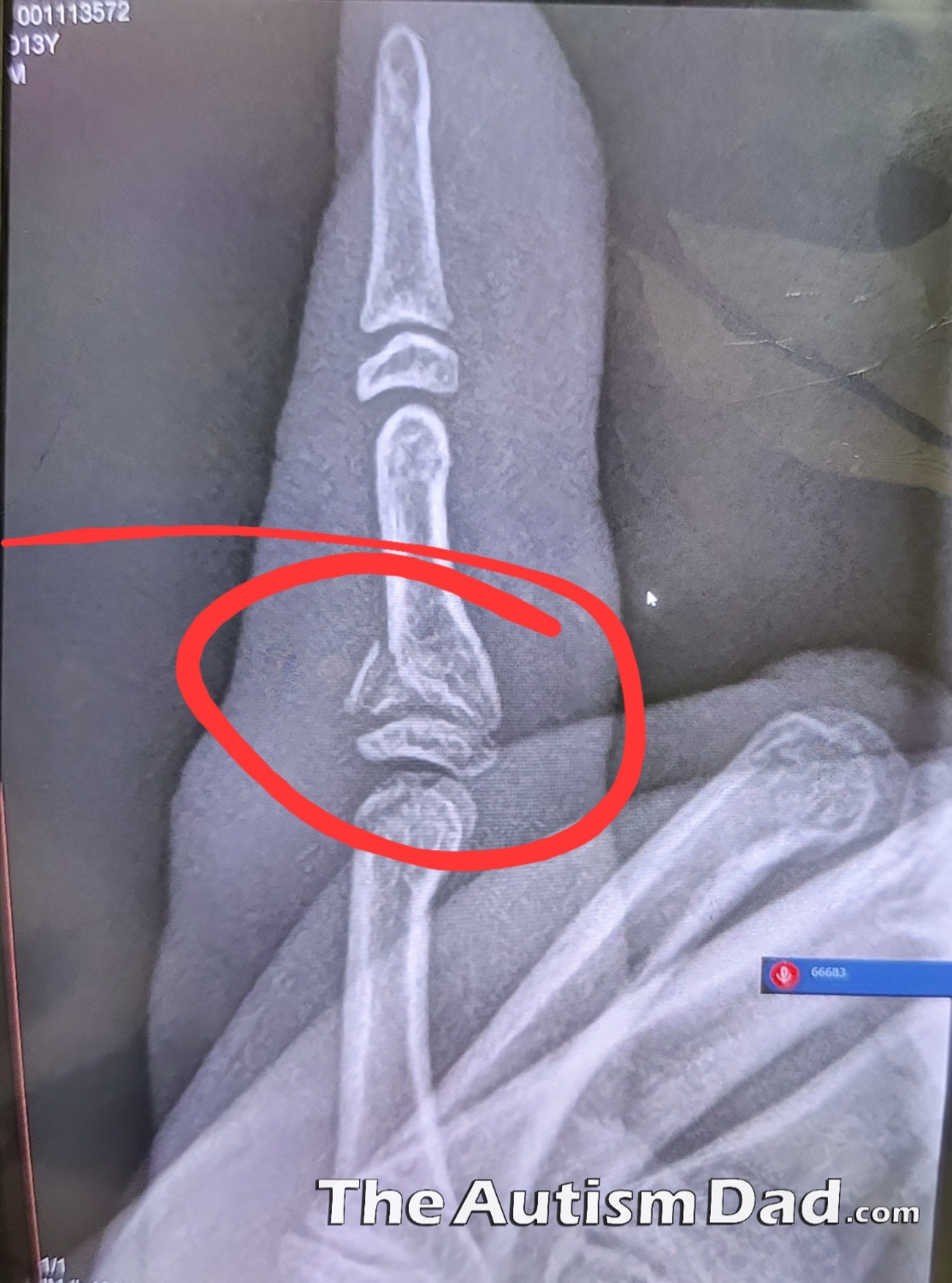 Oh, that's definitely broken