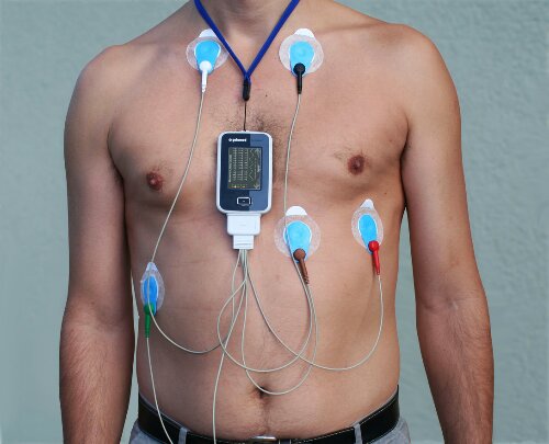 Operation Hope: Enter the Holter Monitor