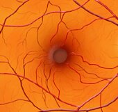 Operation Hope: Retuning to The Cole Eye Center