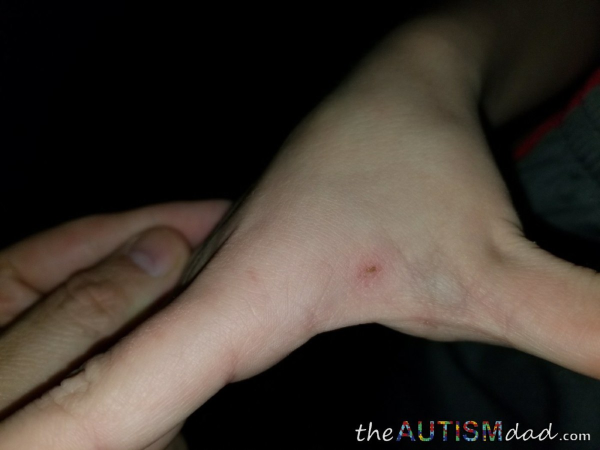 The kid who stabbed Emmett with a pencil is returning to school today and I'm not sure what to think