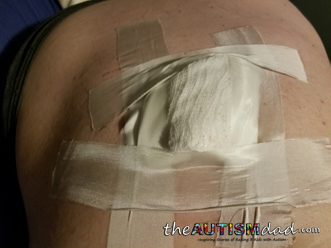 Urgent Care: A gross but necessary update