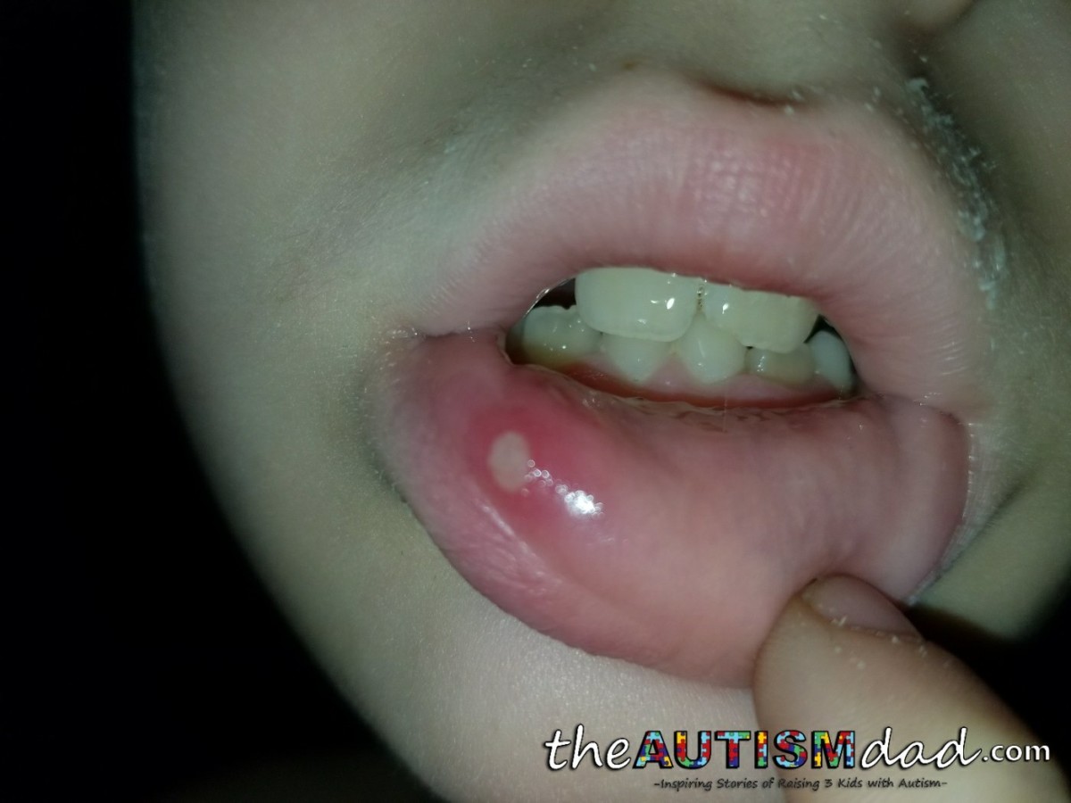 Special Needs Parenting - What it feels like to watch your kids suffer